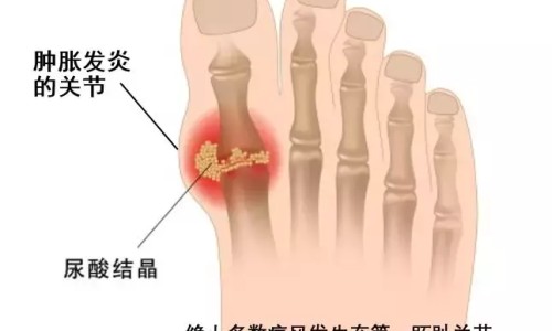 艾滋病怀孕了吃的药孩子可以要吗-艾滋病孕妇生孩子费用专区_艾滋的孕妇生产时怎么处理专区_艾滋病孕妇的产时用药网